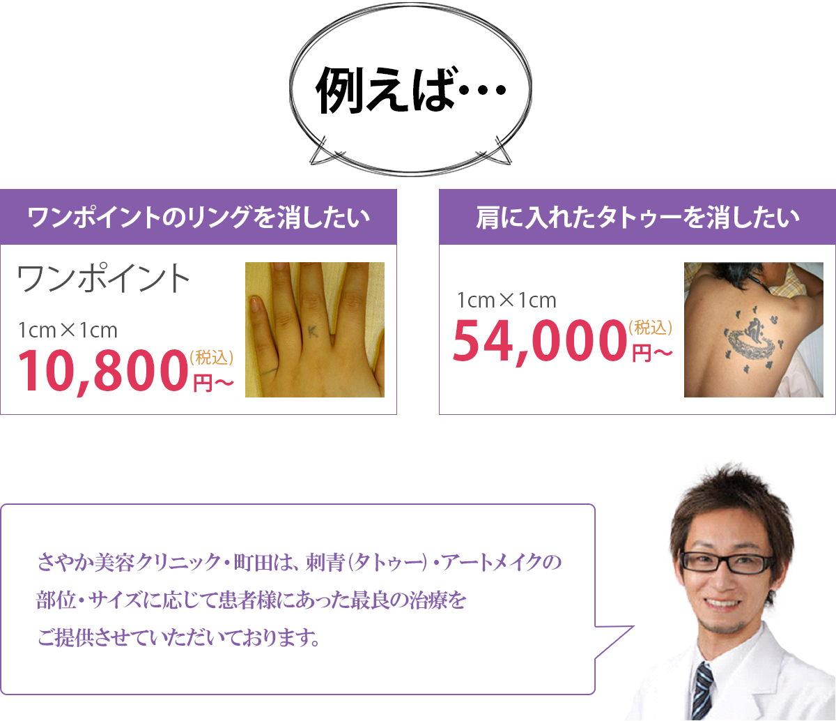 刺青除去の例