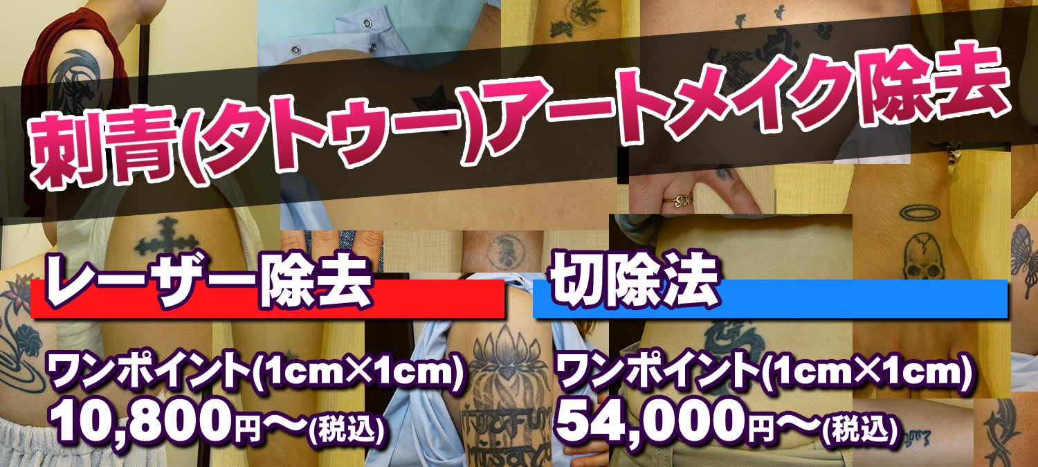 刺青、アートメイク除去のさやか美容クリニック